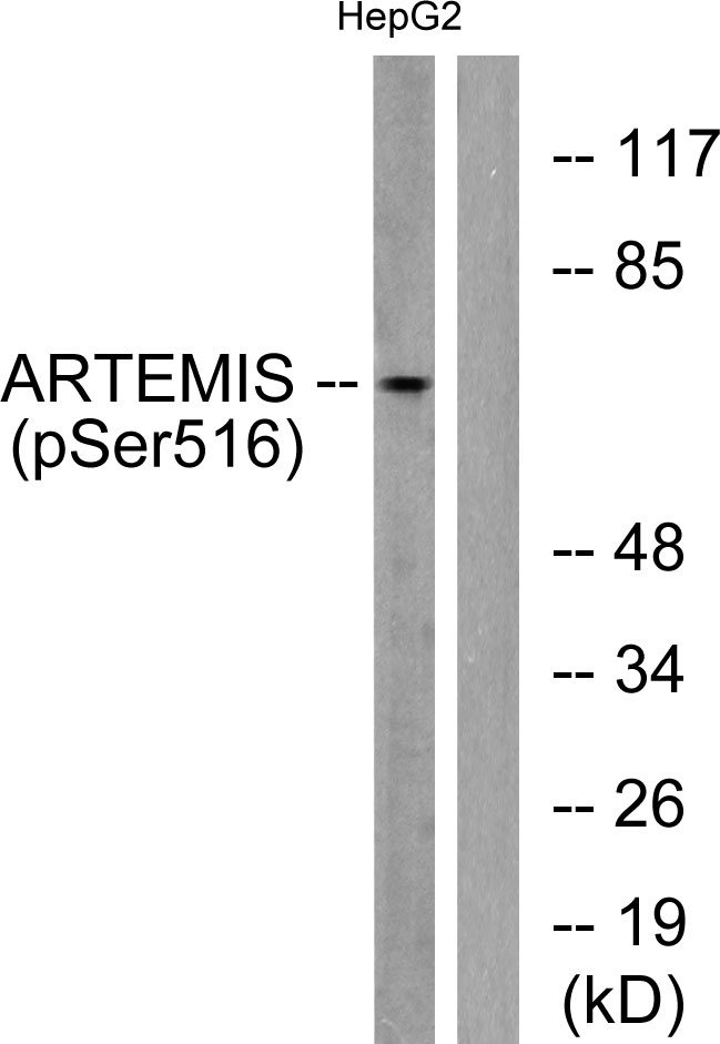 Artemis Phospho Ser516 Rabbit Polyclonal Antibody