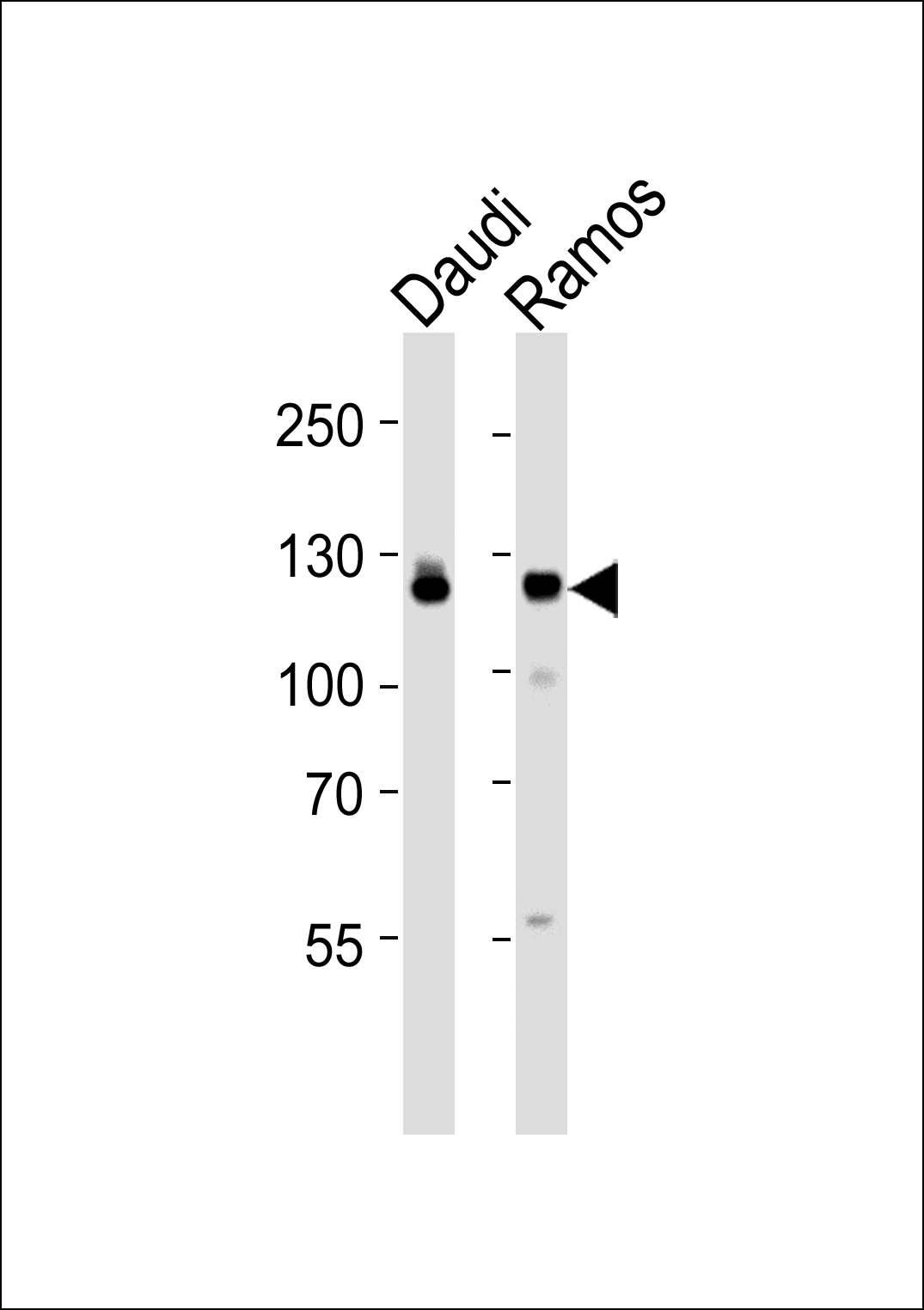 PTK2B Rabbit Polyclonal Antibody (C-term)