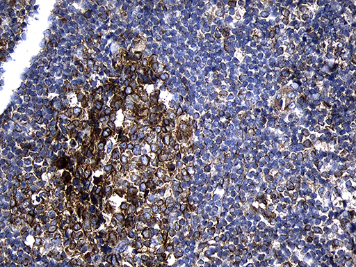 BD PE5226 RNASE11 4Y14 Mouse Monoclonal antibody 现货抗体产品库武汉枢密脑科学技术有限公司