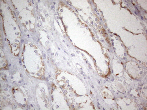 BD PE5227 MRPL10 19V6 Mouse Monoclonal antibody 现货抗体产品库武汉枢密脑科学技术有限公司