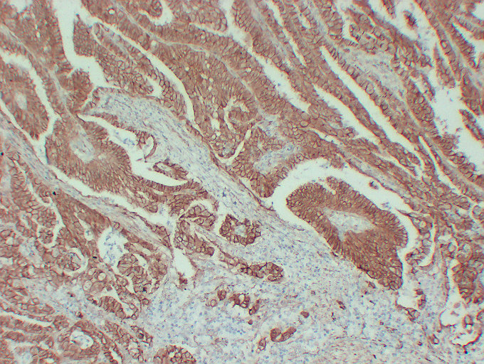 Beta-catenin(2S9) Mouse Monoclonal Antibody