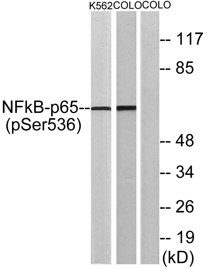 NFκB-p65 (phospho Ser536) Rabbit Polyclonal Antibody