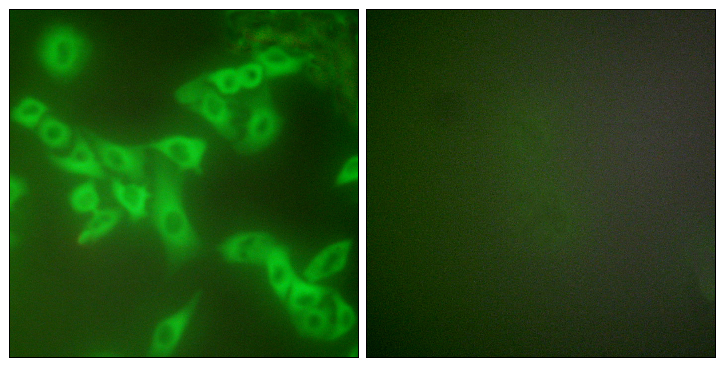 Cystatin B Polyclonal Antibody